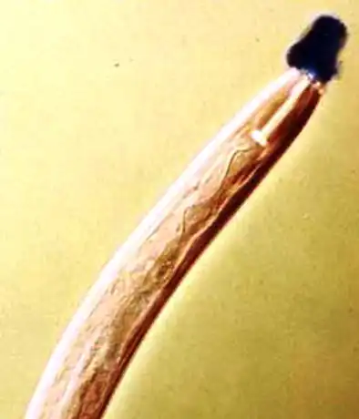 Дитиленхоз лука и чеснока